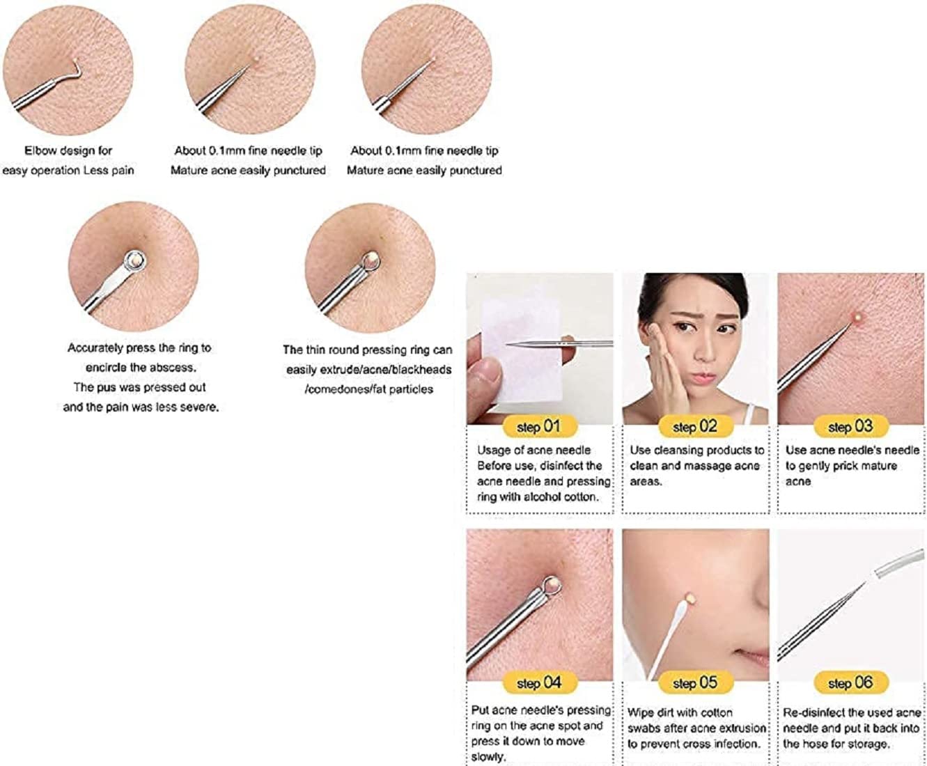 Stainless Steel Blackhead Remover Tool Set - Acne & Pimple Extractor Kit with Blackhead Tweezers & Needles (4-Piece with Plastic Case) - Perfect for Facial Skincare & Blemish Removal at Home