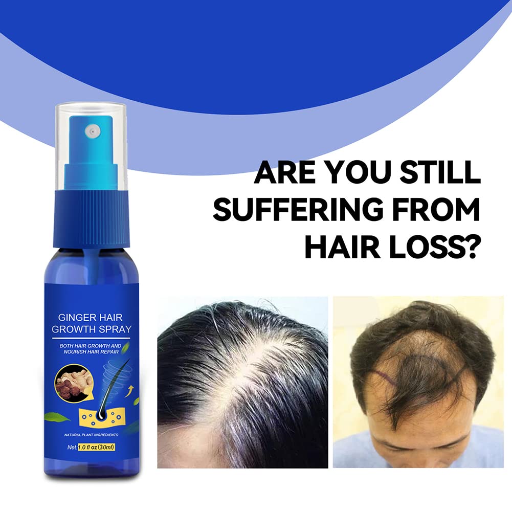 30ml Ginger Hair Regrowth Spray for Men & Women - Natural Hair Growth Serum with Ginger Extract for Thicker Hair & Fuller Beard - Anti Hair Loss Treatment to Strengthen Roots & Moisturize Scalp - Perfect for Daily Use at Home or Travel