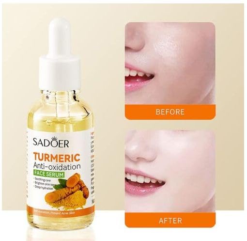 YELURI Turmeric Anti-Oxidant Serum for Dark Spot Correction & Skin Revitalization - 30ml | Brightening Face Treatment for Hyperpigmentation & Dull Skin | Perfect for Daily Skincare Routine & Nighttime Repair