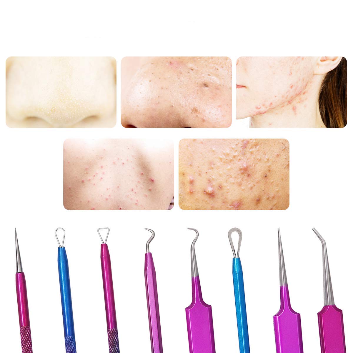 Professional 7-Piece Blackhead Remover & Pimple Extractor Kit - Colorful Acne Comedone Popper Tools for Clear Skin | Perfect for Home Spa, Facial Care & Blemish Treatment