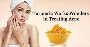 Khadi Rishikesh Ayurvedic Turmeric Sandalwood Face Pack for Acne & Oily Skin - Reduces Pimples, Acne Scars & Pigmentation - 50g - Suitable for Women & Men - Perfect for Daily Skincare Routine & Ayurvedic Beauty Regimen