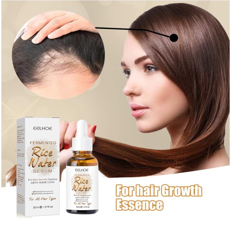 HERBALIX LuxuryHerbs Rice Water Serum for Hair Growth - 30ml Hair Growth Treatment for Thinning Hair & Hair Loss in Women & Men | Strengthens & Nourishes Hair for Daily Use at Home or Salon
