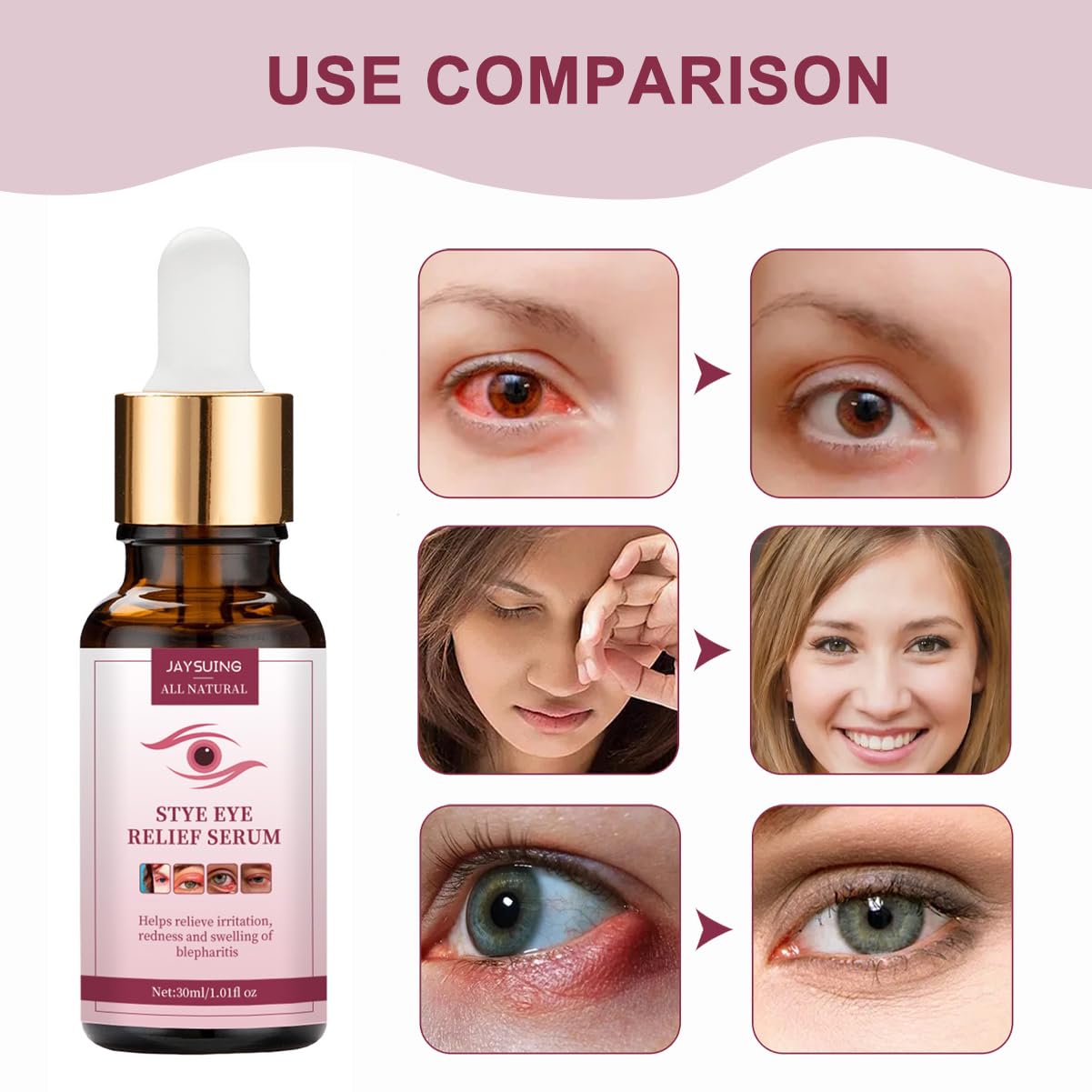 Eye Stye Remover & Treatment for Styes, Chalazion & Blepharitis - Fast Relief Gentle Lash & Eye Cleanser | Perfect for Daily Eye Hygiene & Eyelid Care