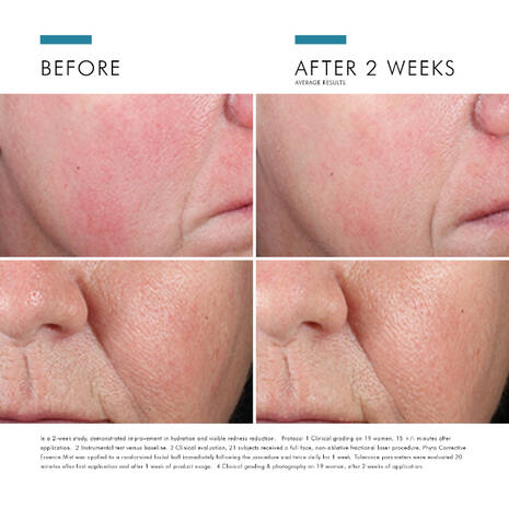 Phyto Corrective Essence Mist - Soothing Facial Spray for Sensitive Skin | Hydrating & Calming Skincare Solution for Dryness & Irritation | Perfect for Post-Workout, Travel & Daily Refresh
