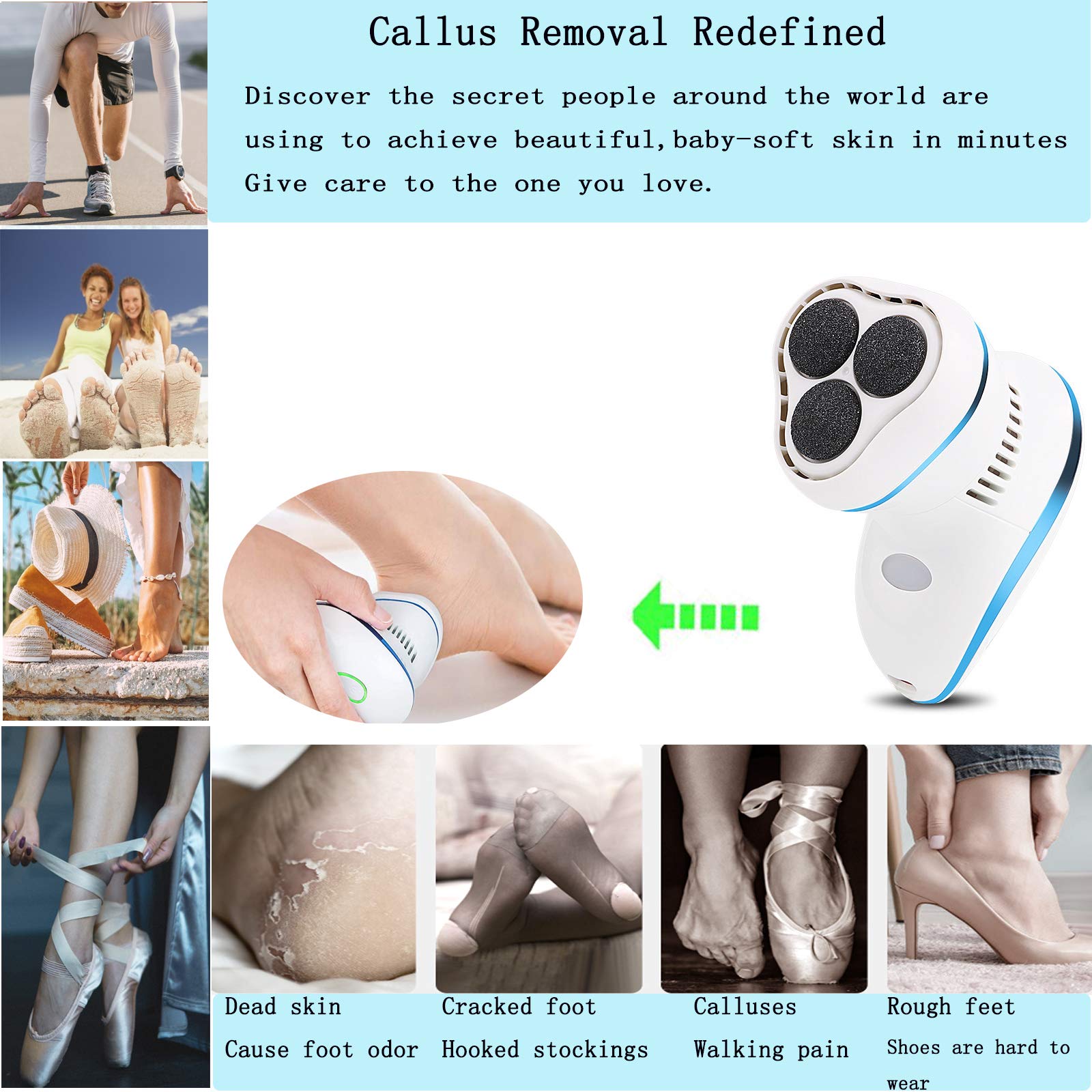 Electric Callus Remover for Feet - Rechargeable Pedicure Tool with Built-in Vacuum, Professional Foot File & Dead Skin Remover for Cracked Dry Heels - At Home Spa & Pedicure Care (Blue)