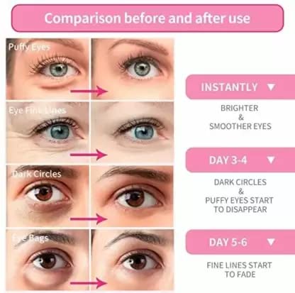 ZSIGNS Hydra Under Eye Vitamin C Serum Patches - Dark Circle & Puffiness Treatment, Anti-Wrinkle Eye Masks for Fine Lines (60 Patches/30 Pairs) | Perfect for Night Routine, Travel & Morning Skincare Prep