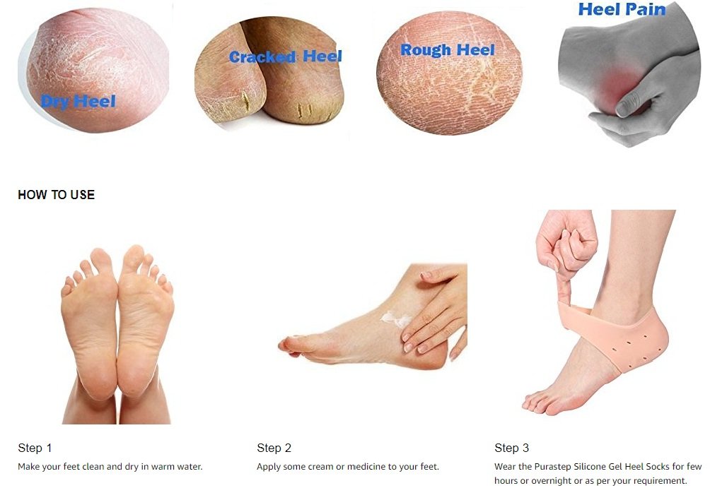 Brezzycloud Silicone Gel Heel Pad Socks for Heel Swelling & Pain Relief, Dry Cracked Heels Repair Cream, Foot Care & Ankle Support Cushion - Men & Women (2 Pairs) - Perfect for Running, Hiking & Daily Comfort