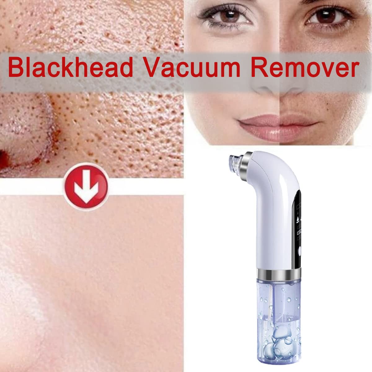 Electric Blackhead Remover Pore Vacuum - Upgraded Facial Pore Cleaner with 3 Suction Power & 6 Probes | USB Rechargeable Acne Comedone Whitehead Extractor Tool for Women & Men | Perfect for Deep Cleansing, Acne Treatment & Skincare Routine