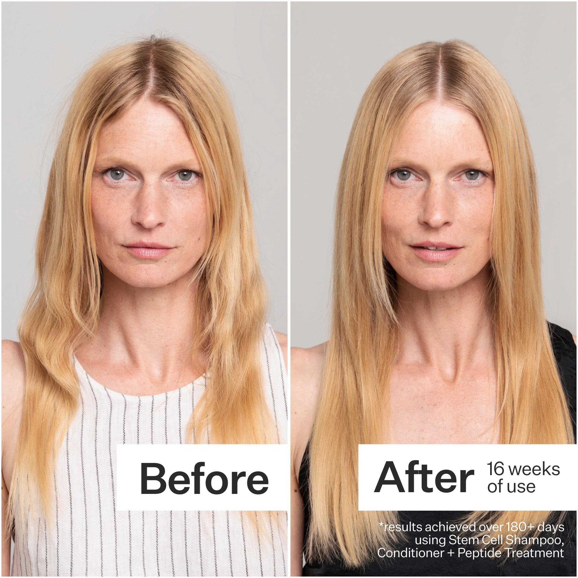Act+Acre Stem Cell Hair Conditioner for Damaged Hair - Repair & Hydrate Dry, Frizzy Hair - Perfect for Daily Use & Post-Color Treatment