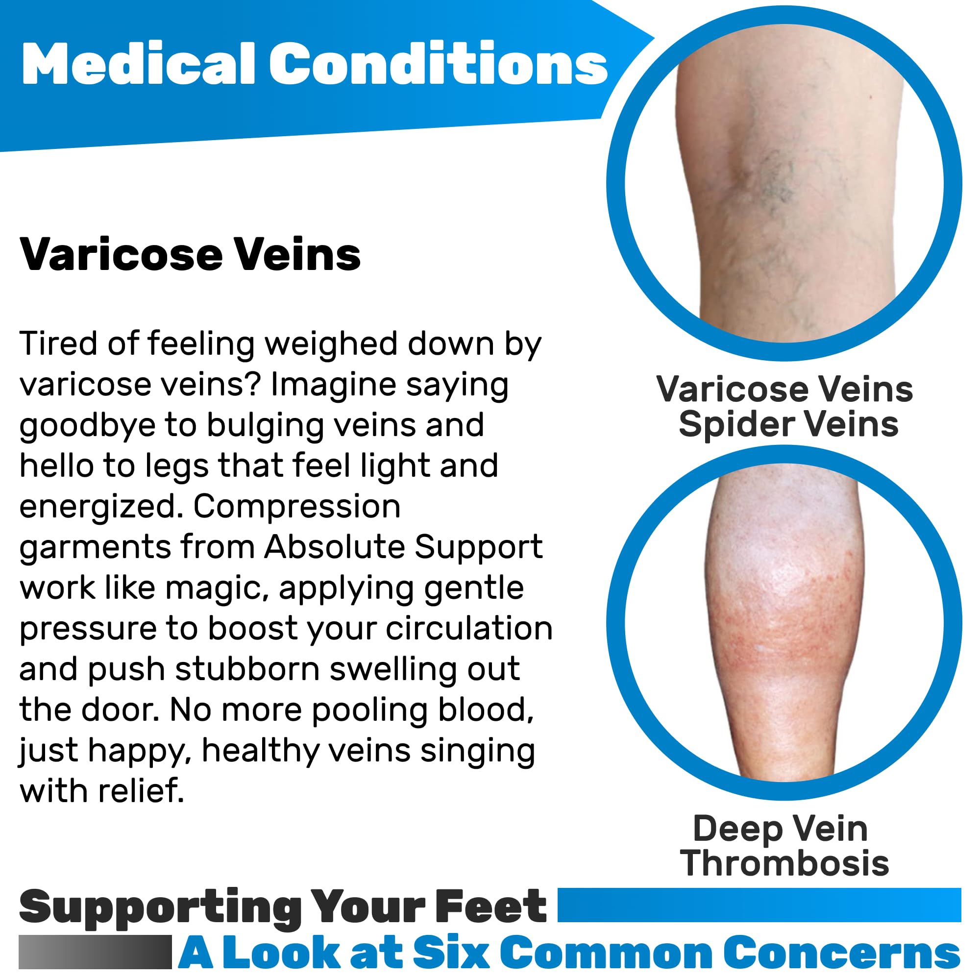 Women's Compression Tights 20-30mmHg for Varicose Veins - Open Toe Pantyhose for Venous Support - Perfect for Daily Wear & Medical Use