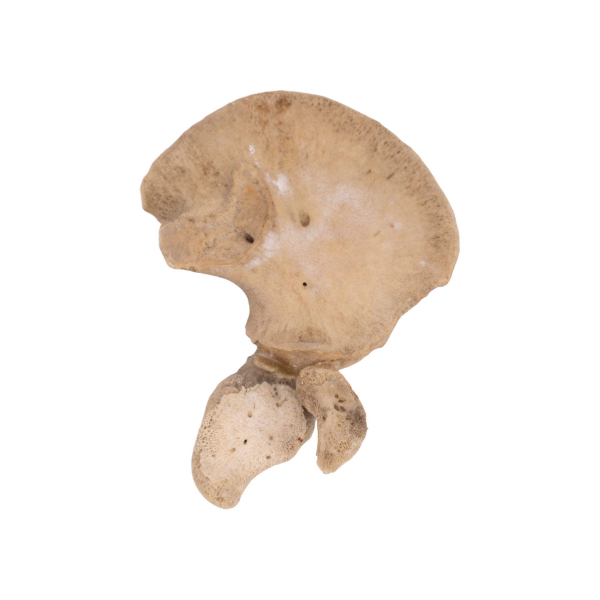 Premium Human Fetal Ilium for Medical Research - High-Quality Anatomical Specimen for Pathology Studies, Medical Education & Scientific Research