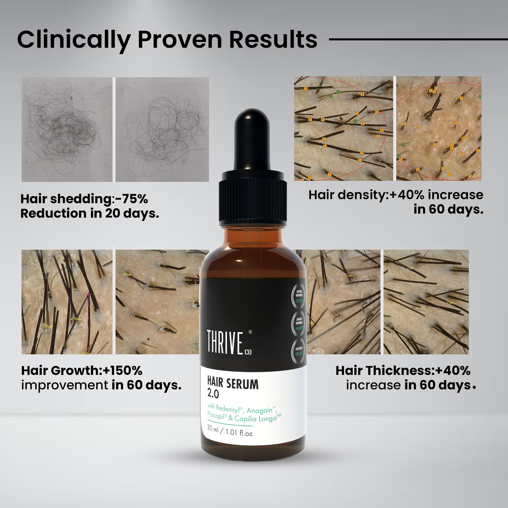 Thriveco Hair Growth Serum & Rosemary Shampoo Set - 50ml Serum + 250ml Shampoo with Caffeine, Castor Oil & Biotin - Natural Hair Loss Treatment for Men & Women - Promotes Thicker, Healthier Hair for Daily Hair Care Routine