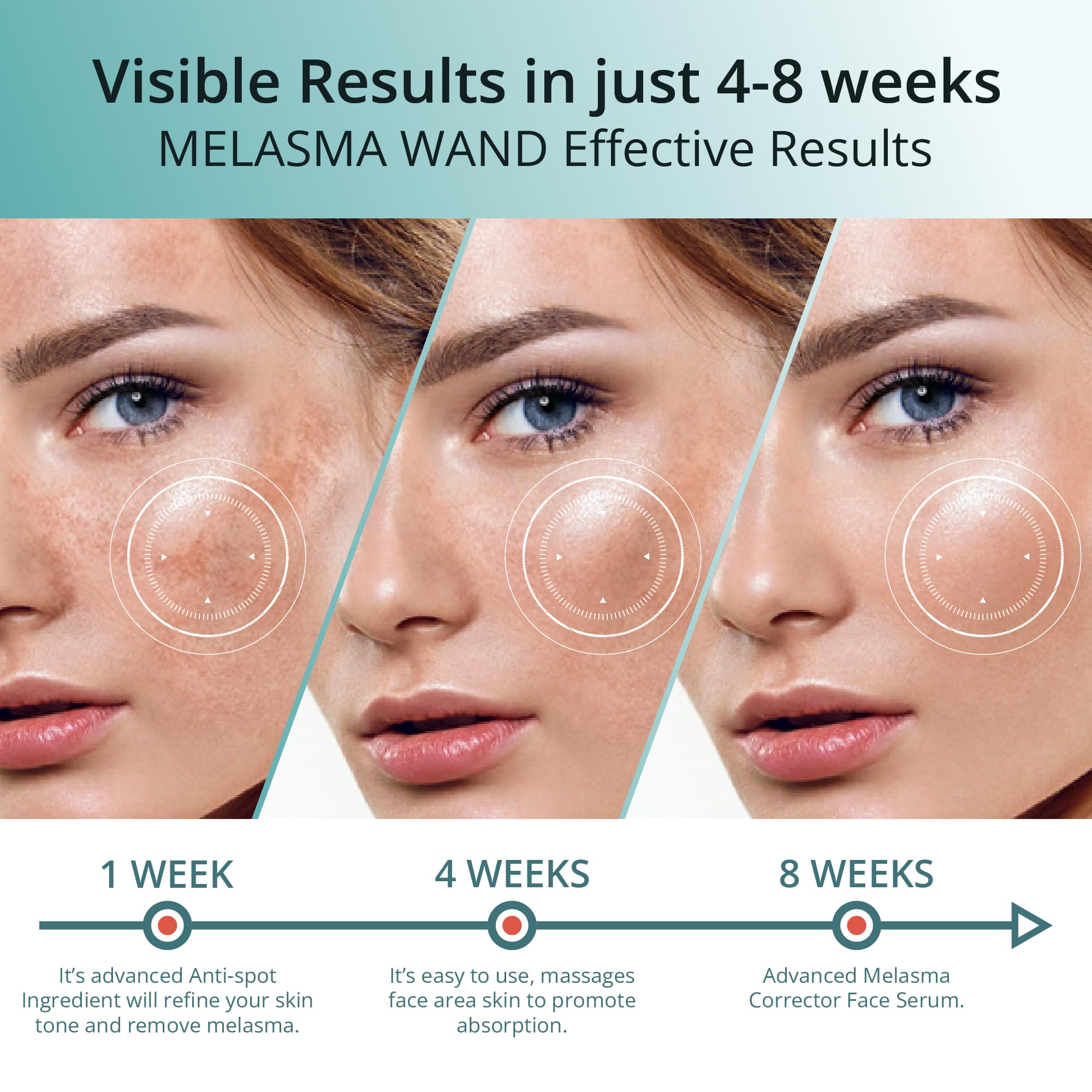 Abera Melasma Serum Plus - Advanced Dark Spot Corrector for Face | Sun Spot, Age Spot & Brown Spot Treatment for Men & Women (1 FL OZ) | Brightens Skin Tone & Reduces Hyperpigmentation | Ideal for Daily Skincare Routine & Post-Sun Care