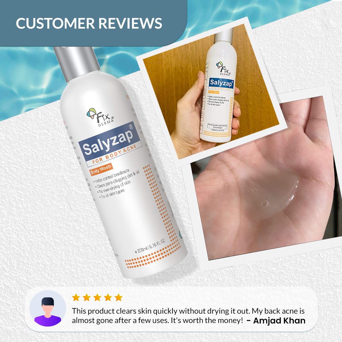 Fixderma Salyzap 2% Salicylic Acid Body Wash for Acne Treatment | Exfoliating & Anti-Acne Body Wash for Back, Chest & Arms | Helps Control Breakouts & Unclog Pores - 200ml | Ideal for Acne-Prone Skin & Daily Shower Routine