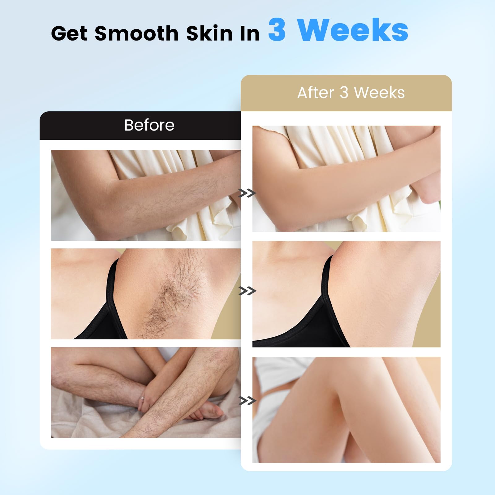 Painless IPL Laser Hair Removal Device with Sapphire Ice Cooling 40℉ & 20J MAX - At-Home Hair Removal for Women & Men, Full Body & Facial Use - Safe & Effective Permanent Hair Reduction for Legs, Underarms, Bikini Line & Face