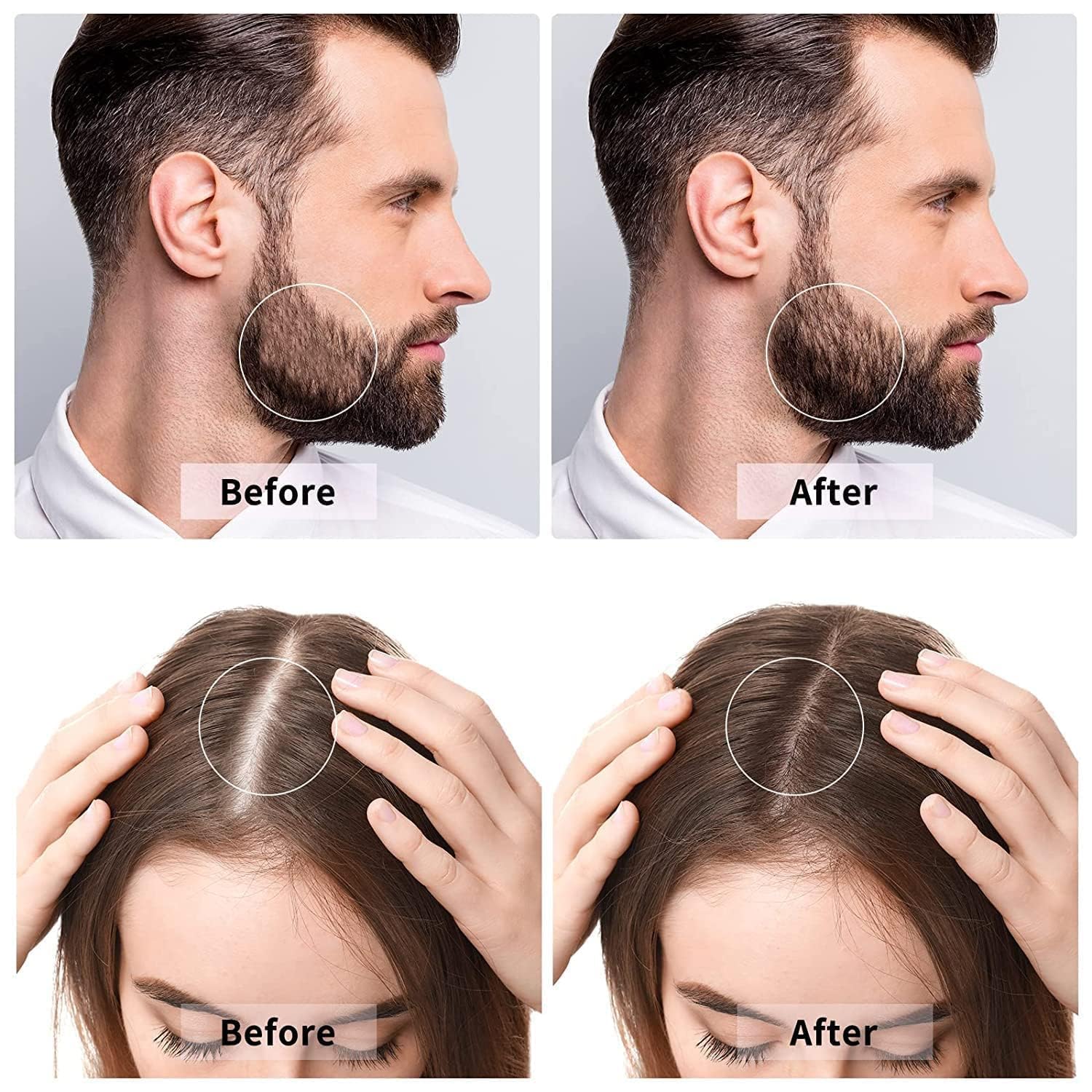 WITBER 540 Titanium Micro Needle Derma Roller for Beard Growth, Hair & Skin Care - 0.25mm Face Roller with Soft Silicone Bristles - Perfect for Men's Grooming, Facial Rejuvenation & Scalp Massage - Great Self Care Gift for Home Spa Treatments