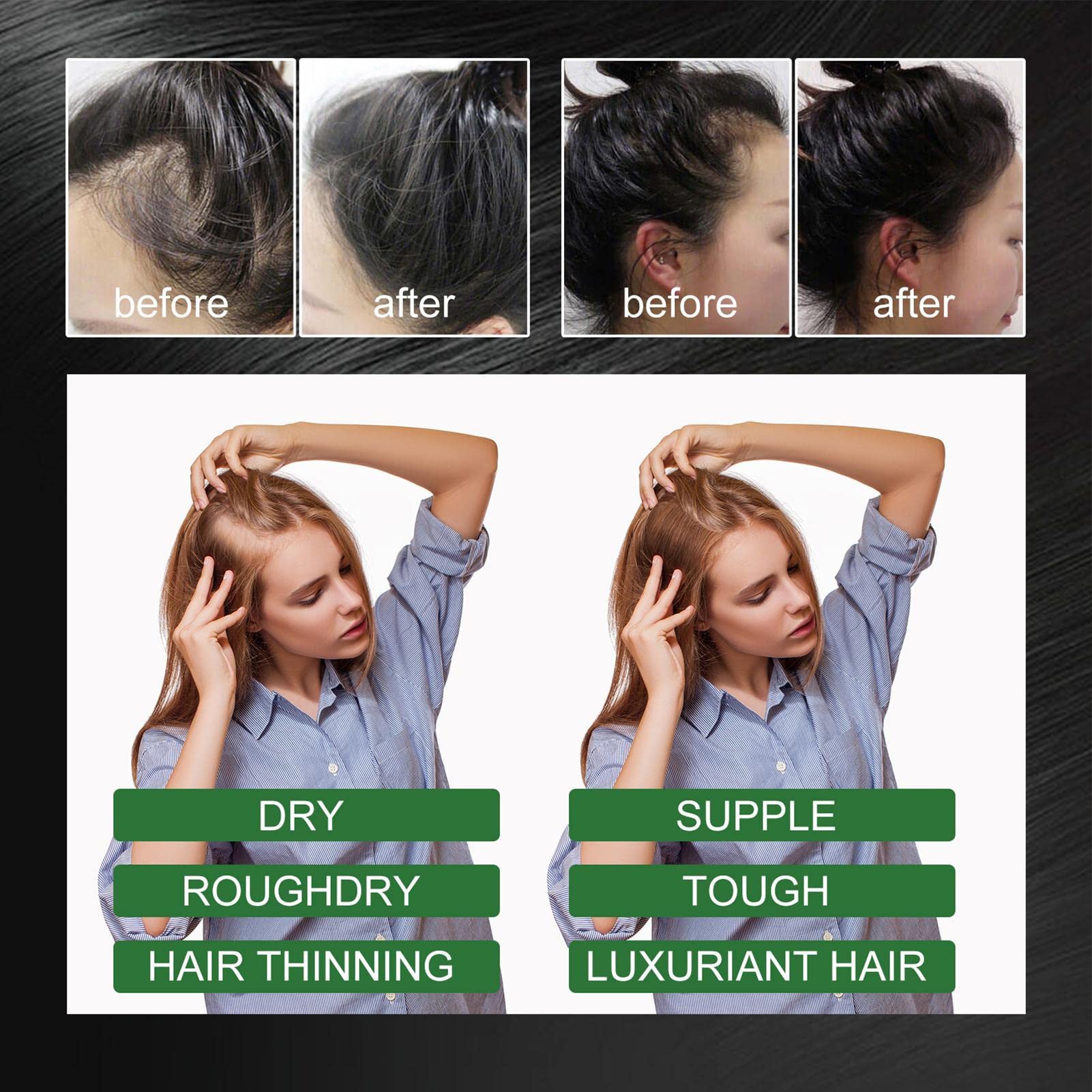 Organic Rosemary Oil for Hair Growth & Scalp Care - 100% Pure Natural Essential Oil for Thicker Hair, Hair Regrowth & Reducing Hair Loss - 60ml Bottle for Daily Hair & Scalp Massage at Home