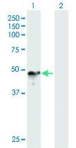 Anti-CHN1 Mouse Polyclonal Antibody (50µl) - High-Quality Research Antibody for Western Blot, Immunohistochemistry & ELISA - Ideal for Neuroscience and Cancer Research Studies