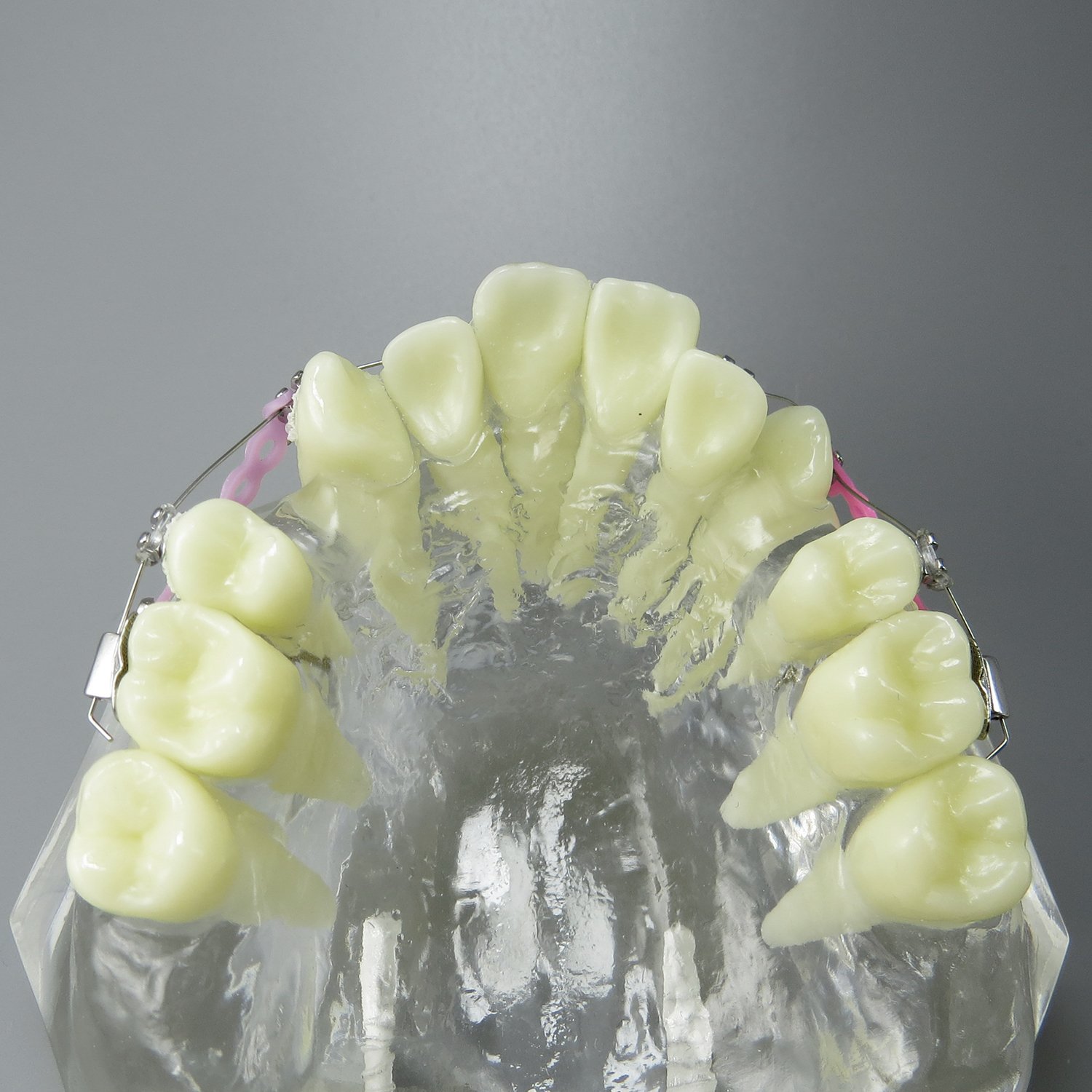 Orthodontic Teeth Model with Metal Brackets & Wires - Dental Malocclusion Treatment Kit with Colorful Ties, Chains & Hoops (M3005) - Perfect for Dental Students, Orthodontic Training & Patient Education