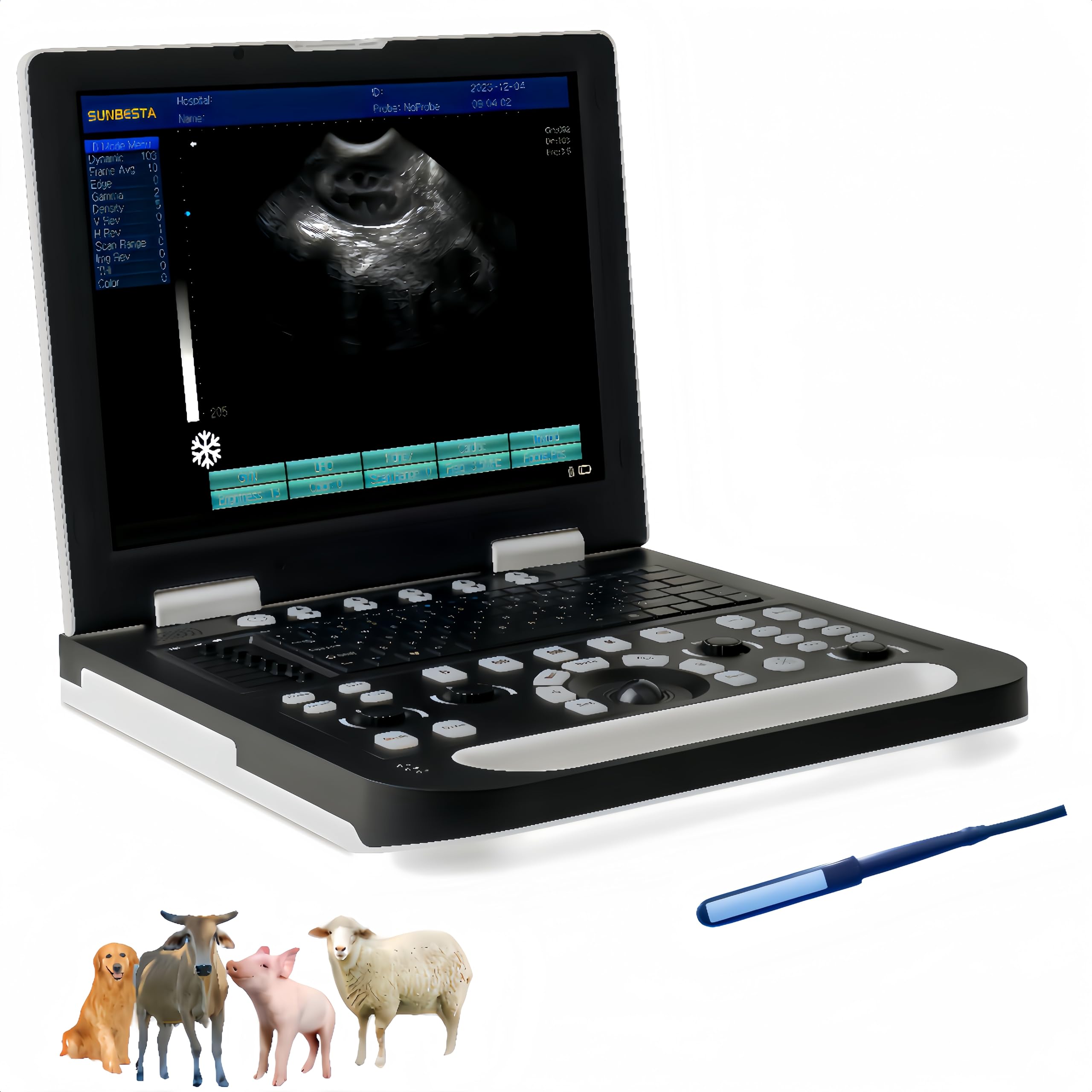 N50 Portable Veterinary Ultrasound Machine for Pregnancy - 15-Inch LCD Home Ultrasound Scanner for Cows, Cattle & Horses - Rectal Linear Probe Included | Ideal for Farm Animal Breeding, Livestock Pregnancy Detection & Veterinary Clinics
