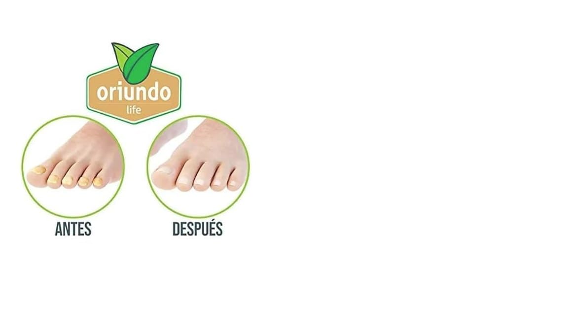Oriundo Natural Life Nail Treatment Solution - 9 Powerful Ingredients for Stronger Nails (3 Month Supply) | Perfect for Damaged, Brittle Nails & Nail Growth Care
