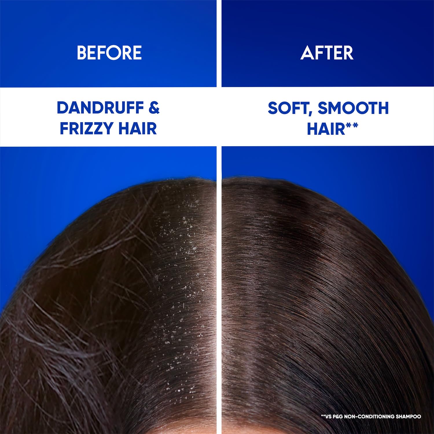 Head & Shoulders 2-in-1 Smooth & Silky Anti-Dandruff Shampoo & Conditioner with Almond Milk - 180ml for Women & Men - Hydrates & Soothes Scalp for Daily Hair Care