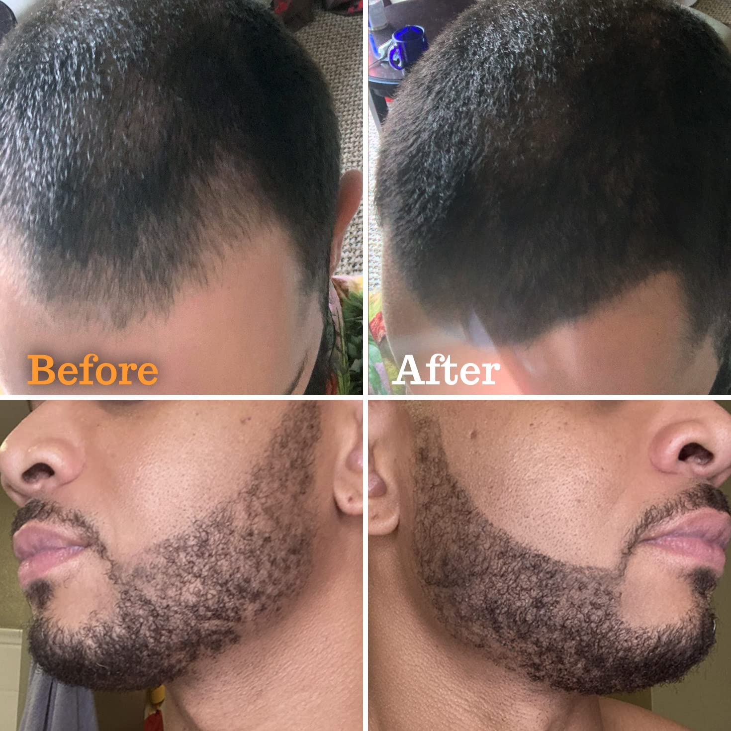 Beard Pencil & Shaper Kit - Black | Grooming & Styling