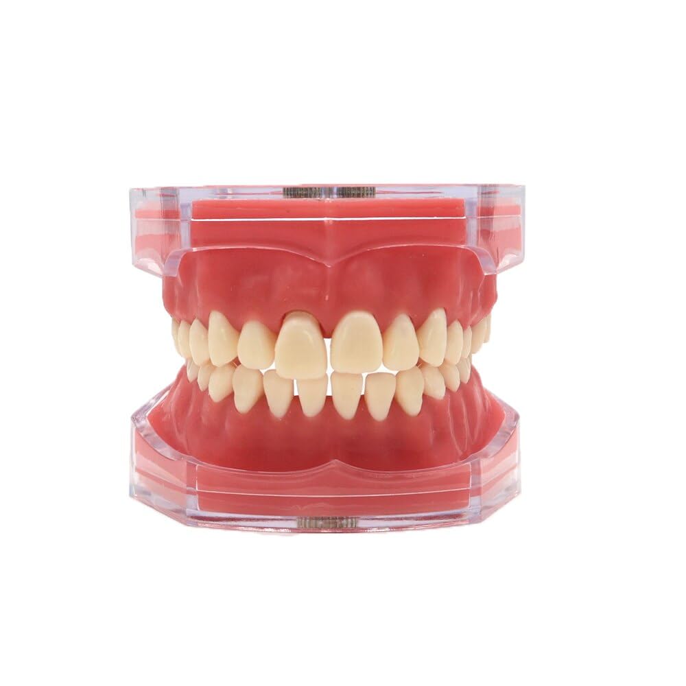 Dental Typodont Model - Standard Removable Soft Gum Teeth Practice Kit for Dentists & Students (M7008-2) | Perfect for Dental Training, Orthodontic Practice & Clinical Demonstrations
