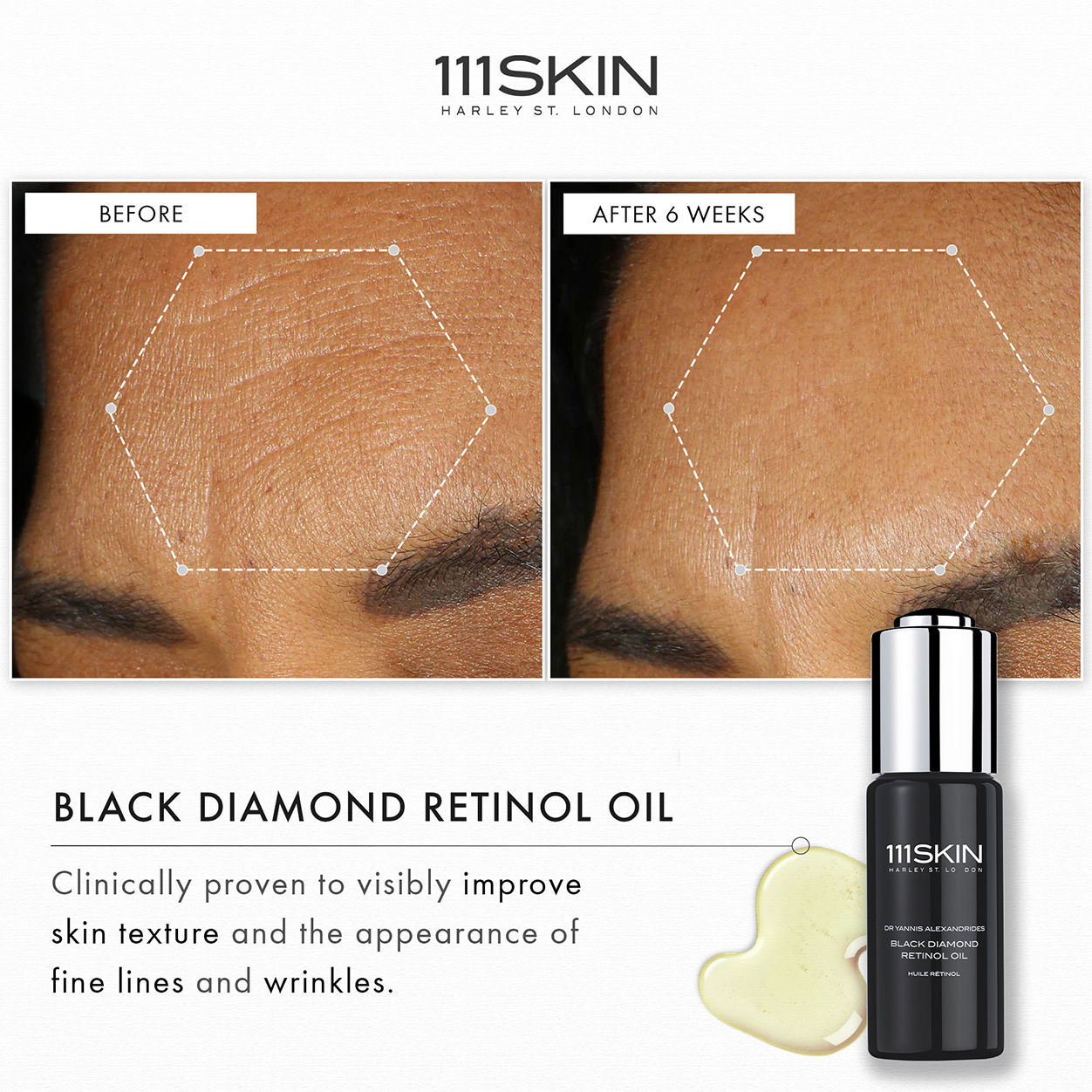Black Diamond Retinol Oil - Anti-Aging Facial Serum for Wrinkles & Fine Lines - Night Repair Treatment for Glowing Skin | Perfect for Dry, Sensitive & Mature Skin Care Routine