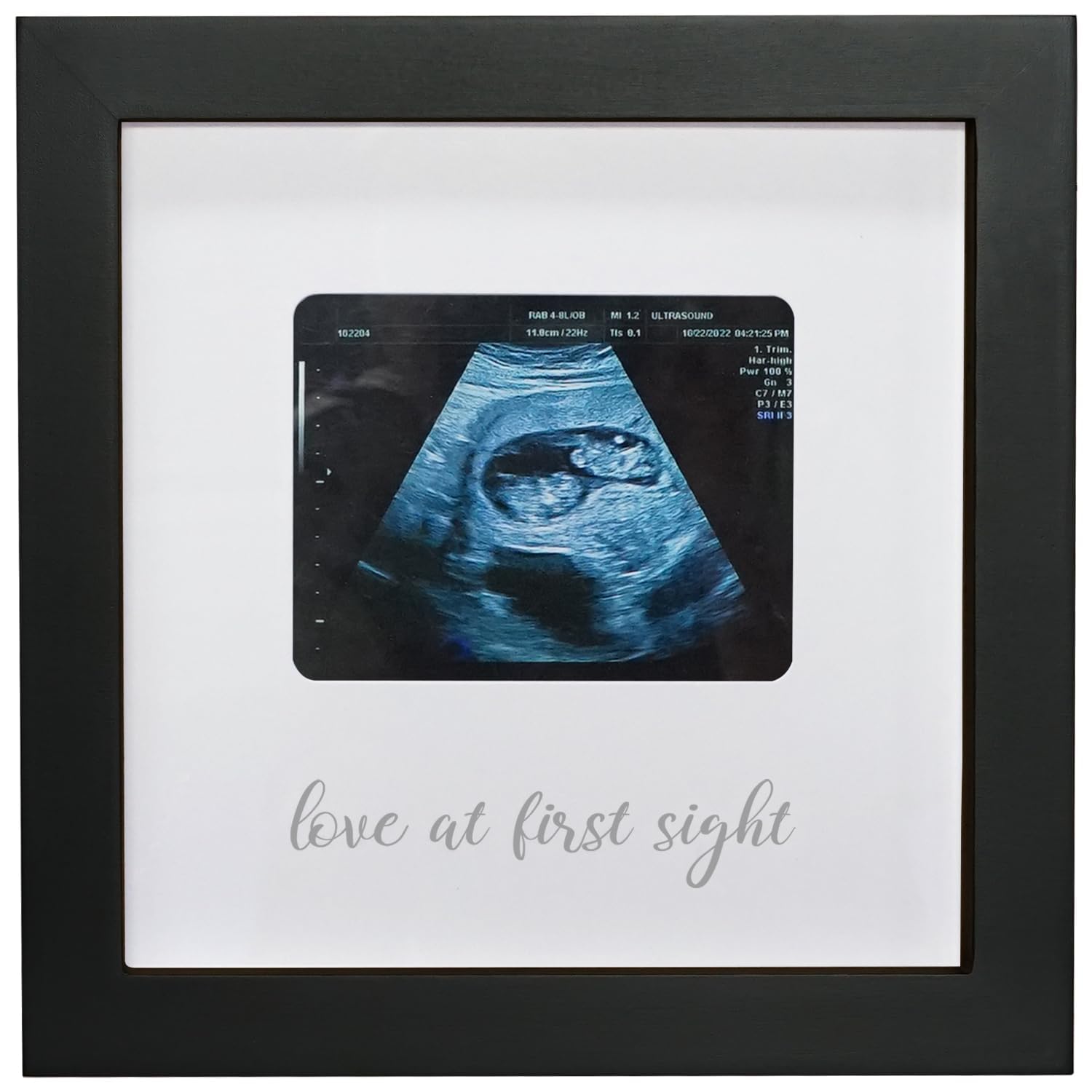 Ultrasound Photo Frame - Pregnancy Announcement Gift for Grandparents - Nursery Decor