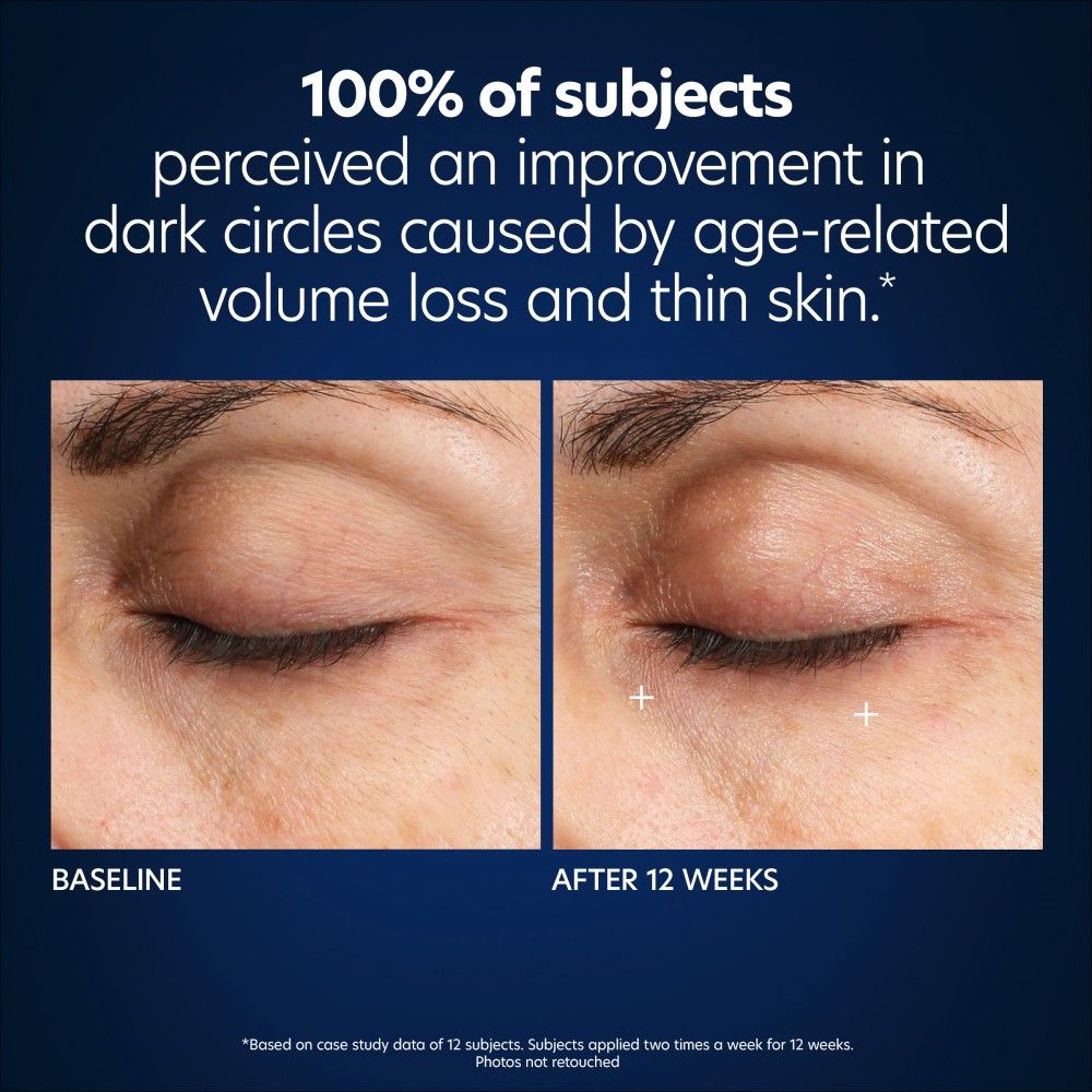 Hyaluronic Acid Microneedle Eye Patches for Dark Circles & Wrinkles - Under Eye Treatment for Puffiness & Fine Lines - Perfect for Night Routine & Travel Skincare