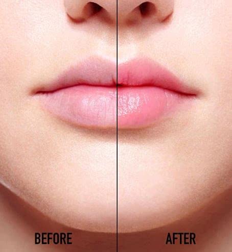 Crazy Lips Moisturizing Lip Balm - 12 Pack Multi-Flavor Glossy Lip Care (4.5g Each) for Dry, Chapped Lips - Perfect for Daily Hydration, Winter Protection & On-The-Go Use