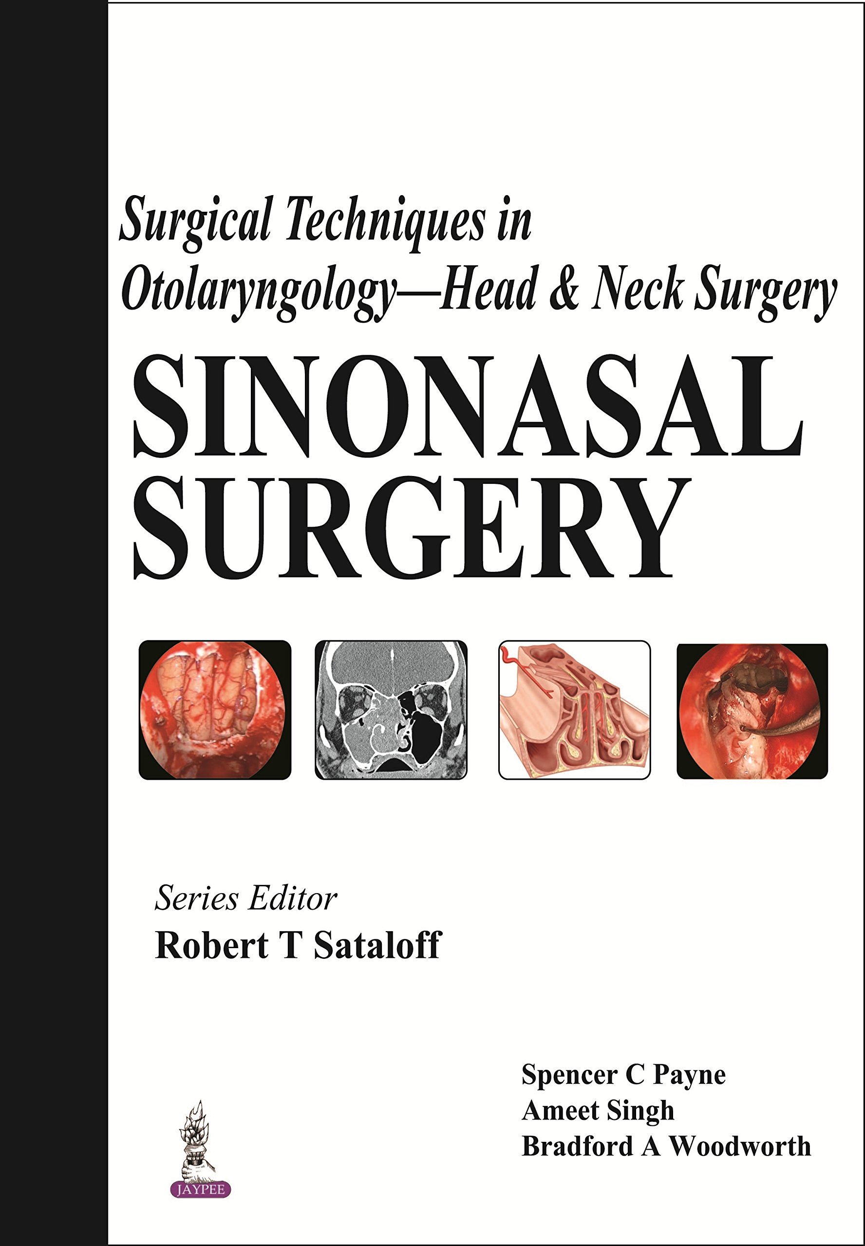 Sinonasal Surgery: Advanced Techniques in Otolaryngology & Head-Neck Procedures | ENT Surgical Guide for Nasal Disorders & Sinus Treatments