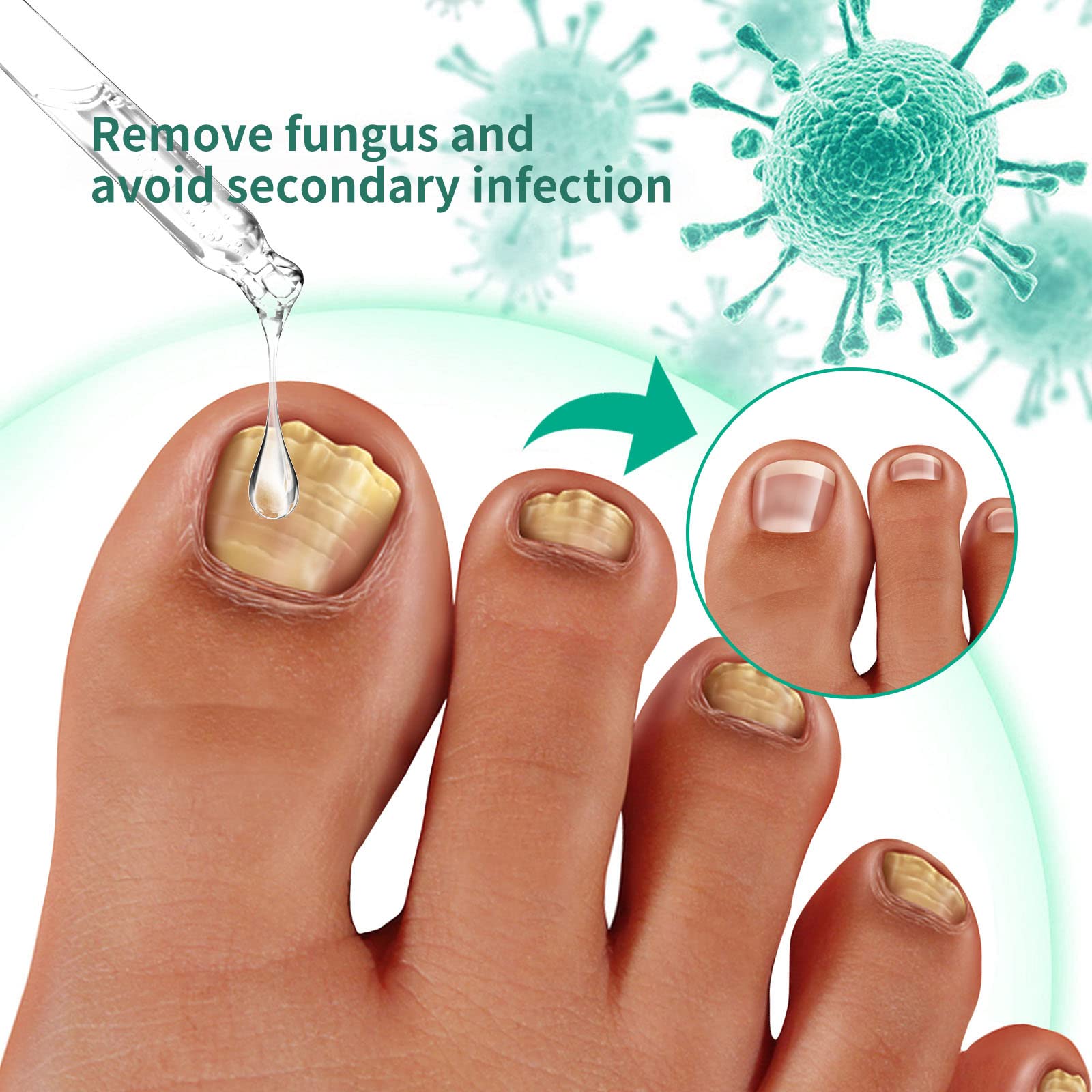 Kerassentials Toenail Fungus Treatment Oil - Natural Nail Repair Solution for Fungal Infections (3 Pack) - Perfect for Athletes, Swimmers & Daily Foot Care