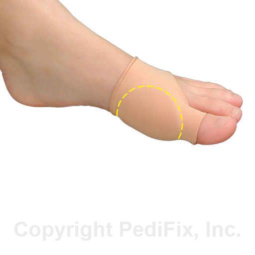 PediFix ViscoGEL Bunion Relief Sleeve - Comfortable Toe Protector for Bunions & Hammertoes - Pain Relief & Support for Women & Men - Perfect for Running, Walking & Daily Activities