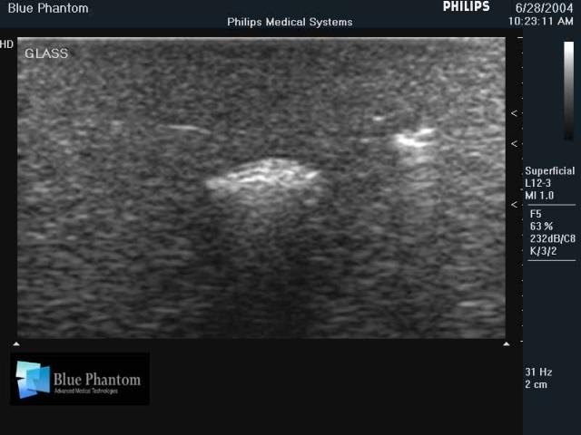 Foreign Body Identification Ultrasound Training Model - High-Quality Medical Simulation Tool for Emergency & Trauma Practice - Perfect for Medical Students, Nurses & First Responders