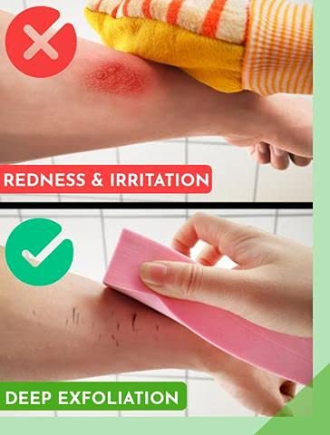 Exfoliating Face Scrubber & Dead Skin Remover - Gentle Bath Sponge for Men & Women - 2 Pack Random Colors - Perfect for Daily Skincare & Shower Routine