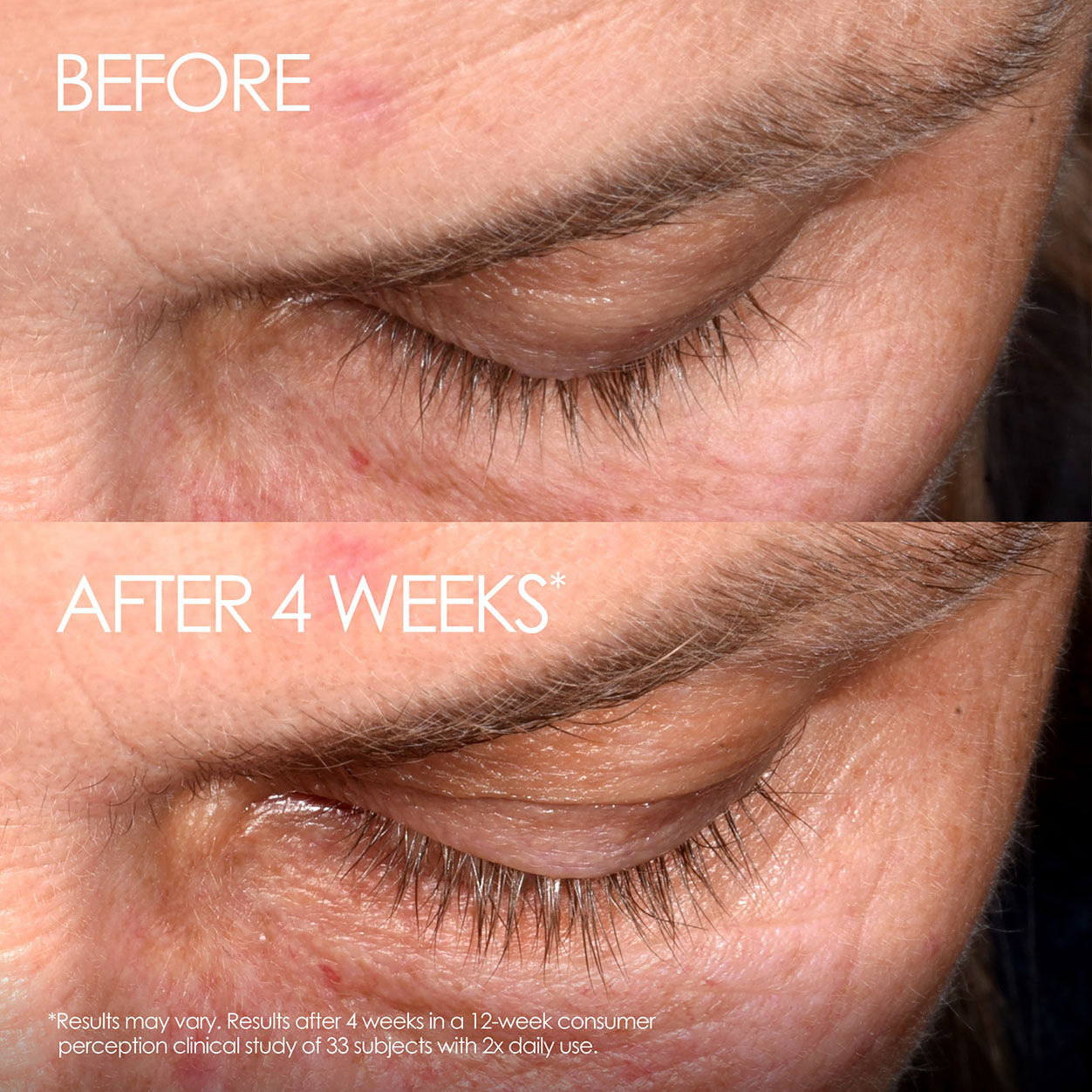 Lashbond Eyelash Growth Serum - Natural Lash Enhancer for Longer, Thicker Lashes | Perfect for Daily Use & Special Occasions