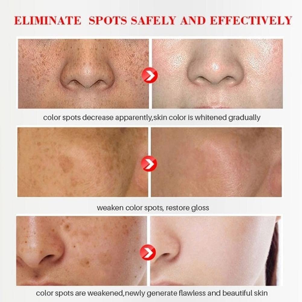 Plant-Based Melanin Freckle Lightening Cream - Dark Spot Corrector & Skin Whitening Treatment for Face (2pc) | Brightens Complexion, Reduces Freckles & Hyperpigmentation | Perfect for Daily Skincare Routine & Evening Skin Tone