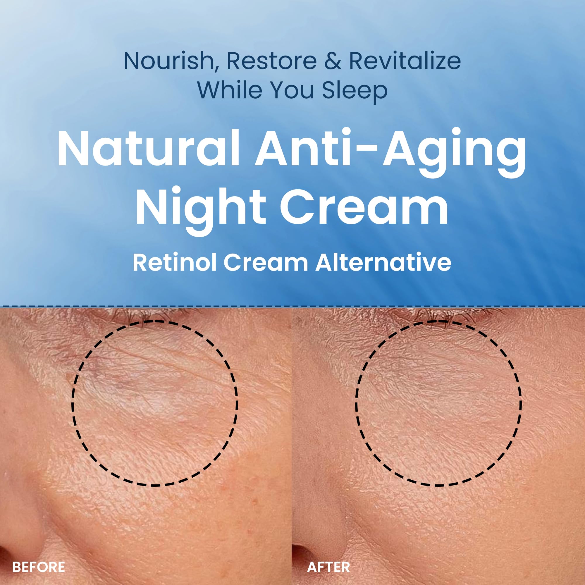 THENA Overnight Recovery Cream - Anti-Aging Night Face Moisturizer with Collagen for Women & Men | Organic & Natural Skincare | Deep Hydration & Wrinkle Reduction | Perfect for Nighttime Skin Repair & Rejuvenation