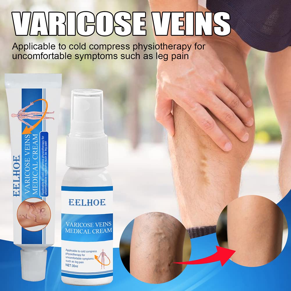 Varicose Veins Miracle Cream - Spider Vein Treatment for Legs | Phlebitis Relief & Muscle Soreness Solution | Fast-Acting Leg Cramp Relief | Perfect for Daily Use & Post-Workout Recovery