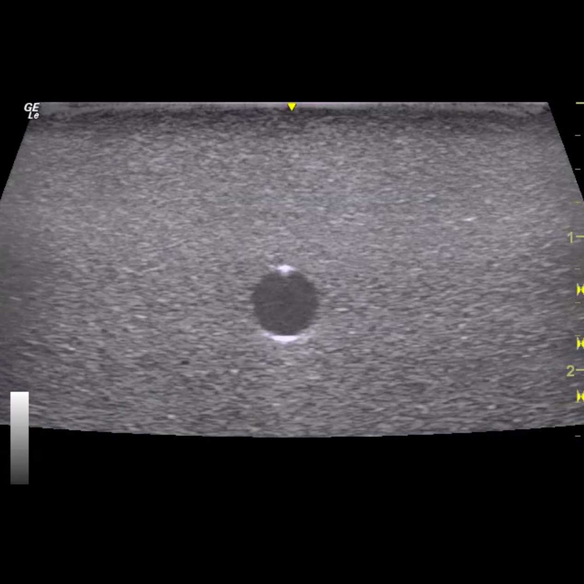 HM2.0 Remoldable 2-Vessel Ultrasound Training Model - Perfect for Medical Students & Sonography Practice (Arterial & Venous Vessel Simulation)