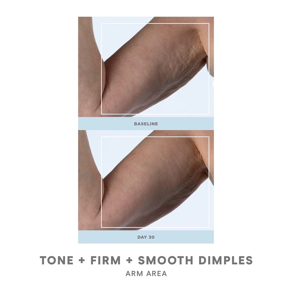 NuFACE NuBODY Body Toning Device - Professional Skin Tightening & Contouring for Arms, Legs & Abs | At-Home Body Sculpting & Anti-Aging Treatment