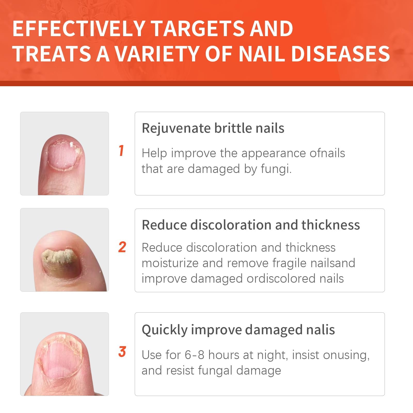 Extra Strength Toenail Fungus Treatment - 32 Pcs Nighttime Renewal Patches for Effective Symptom Relief & Visible Results | Fungal Nail Care for Athletes, Swimmers & Active Lifestyles