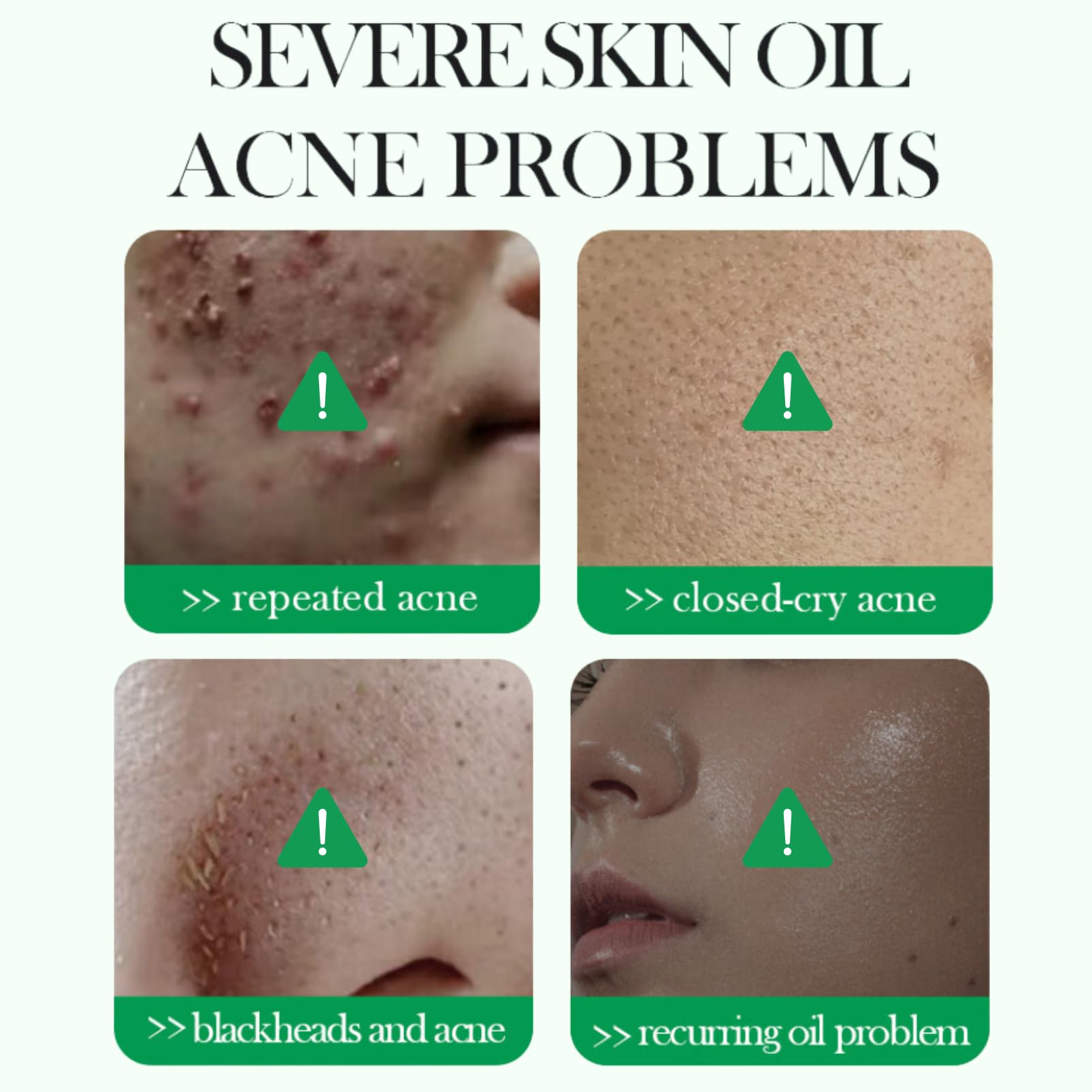 3% Salicylic Acid Exfoliating Face Pads for Acne Prone Skin - Korean Skincare Toner Pads for Blackhead Treatment & Oil Control - Gentle Daily Exfoliator Wipes (55 Count, 110g) - Perfect for Morning/Night Routine & Travel Skincare