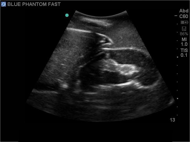 FAST Exam Real Time Ultrasound Training Model - Transthoracic Only for Emergency Medicine & Trauma Assessment Practice (Medical Simulation, Sonography Education, TTE Training)