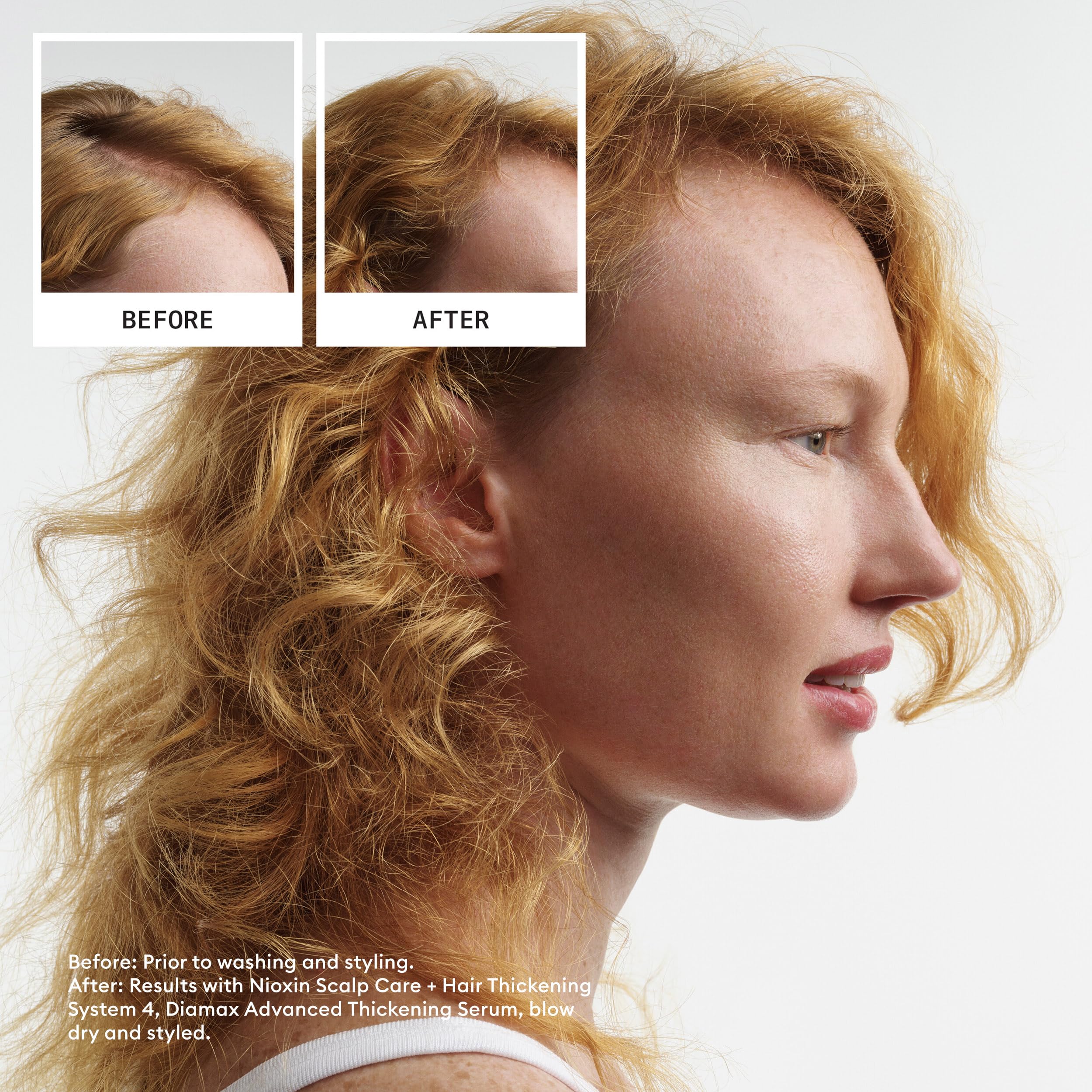 Nioxin System 4 Scalp Cleansing Shampoo & Therapy Conditioner Set for Color-Treated Hair with Thinning - Hair Growth Treatment for Thinning Hair - Perfect for Daily Use at Home & Salon