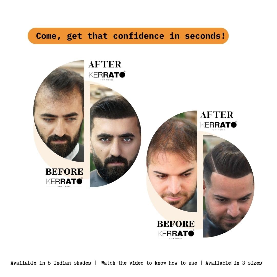 Kerrato Natural Hair Fibres for Thinning Hair - Light Brown 28g | Instant Hair Loss Concealer in 10 Seconds | Hair Thickening Fibers for Men & Women | Perfect for Daily Use, Special Occasions & Confidence Boosting