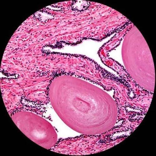 AmScope M150 Series Portable Student Monocular Compound Microscope - 40X-1000X Magnification with LED Illumination & 25 Prepared Slides - Coarse & Fine Focus Adjustment - Perfect for Home Schooling, Science Classrooms & Biology Labs