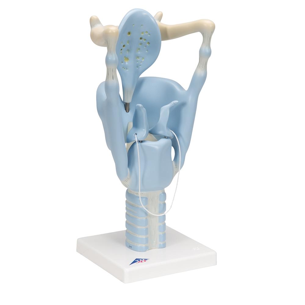 3X Enlarged Functional Larynx Anatomy Model - Human Voice Box Medical Teaching Tool for Doctors, Students & Speech Therapists | Perfect for Classroom Demonstrations & Clinical Training